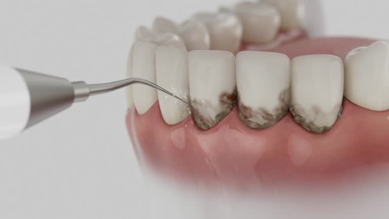 Reliable Emergency Dentist contractor in Miller, SD by Smile Center Dentistry
